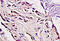 Low Density Lipoprotein Receptor antibody, 250514, Abbiotec, Immunohistochemistry paraffin image 
