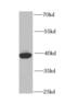 Poly(rC)-binding protein 2 antibody, FNab06191, FineTest, Western Blot image 