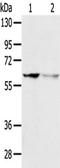 24-Dehydrocholesterol Reductase antibody, TA350394, Origene, Western Blot image 