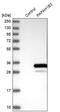 Platelet Activating Factor Acetylhydrolase 1b Catalytic Subunit 3 antibody, PA5-57349, Invitrogen Antibodies, Western Blot image 