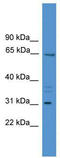 Matrix Extracellular Phosphoglycoprotein antibody, TA341733, Origene, Western Blot image 