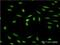 ISL LIM Homeobox 1 antibody, H00003670-M03, Novus Biologicals, Immunofluorescence image 