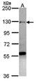 Zinc Finger Protein 574 antibody, orb73654, Biorbyt, Western Blot image 
