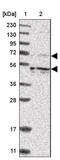 Kinesin Family Member 12 antibody, NBP1-85984, Novus Biologicals, Western Blot image 