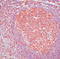 Caspase 3 antibody, LS-C88631, Lifespan Biosciences, Immunohistochemistry paraffin image 