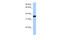 Occludin/ELL Domain Containing 1 antibody, 30-647, ProSci, Enzyme Linked Immunosorbent Assay image 