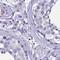 Rho Guanine Nucleotide Exchange Factor 35 antibody, HPA045699, Atlas Antibodies, Immunohistochemistry paraffin image 