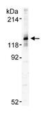 Stromal Antigen 1 antibody, GTX24455, GeneTex, Western Blot image 