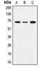 Sorting nexin-1 antibody, LS-C352867, Lifespan Biosciences, Western Blot image 
