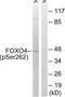 Forkhead Box O4 antibody, LS-C198979, Lifespan Biosciences, Western Blot image 