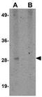 Synaptophysin Like 1 antibody, GTX85262, GeneTex, Western Blot image 