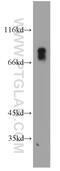 V-Set And Immunoglobulin Domain Containing 1 antibody, 14145-1-AP, Proteintech Group, Western Blot image 