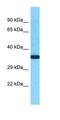 Olfactory Receptor Family 10 Subfamily K Member 2 antibody, orb327065, Biorbyt, Western Blot image 