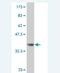 Cell Division Cycle 25B antibody, H00000994-M01, Novus Biologicals, Western Blot image 