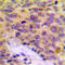 Mitochondrial Ribosomal Protein L16 antibody, LS-C354178, Lifespan Biosciences, Immunohistochemistry paraffin image 