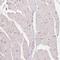 CD2 Cytoplasmic Tail Binding Protein 2 antibody, HPA061309, Atlas Antibodies, Immunohistochemistry paraffin image 