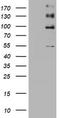 ALK Receptor Tyrosine Kinase antibody, TA801291S, Origene, Western Blot image 