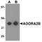 Adenosine A2b Receptor antibody, TA349146, Origene, Western Blot image 