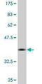 Lon Peptidase 1, Mitochondrial antibody, H00009361-M01, Novus Biologicals, Western Blot image 