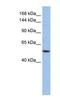 Ubiquitination Factor E4A antibody, NBP1-55038, Novus Biologicals, Western Blot image 