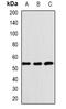 SWI/SNF Related, Matrix Associated, Actin Dependent Regulator Of Chromatin, Subfamily E, Member 1 antibody, orb382047, Biorbyt, Western Blot image 