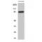 CHM Like Rab Escort Protein antibody, LS-C385809, Lifespan Biosciences, Western Blot image 