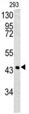 Serpin B3 antibody, AP17760PU-N, Origene, Western Blot image 