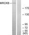 CDC42 Binding Protein Kinase Beta antibody, TA314936, Origene, Western Blot image 