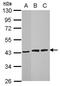 3-Hydroxyisobutyryl-CoA Hydrolase antibody, PA5-28949, Invitrogen Antibodies, Western Blot image 