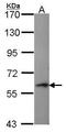 Perforin 1 antibody, TA308615, Origene, Western Blot image 