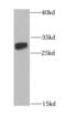 Nicotinamide N-Methyltransferase antibody, FNab05773, FineTest, Western Blot image 