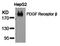 Platelet Derived Growth Factor Receptor Like antibody, orb14609, Biorbyt, Western Blot image 