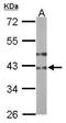 UDP-GlcNAc:BetaGal Beta-1,3-N-Acetylglucosaminyltransferase 3 antibody, TA308090, Origene, Western Blot image 