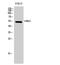 VRK Serine/Threonine Kinase 3 antibody, GTX34294, GeneTex, Western Blot image 