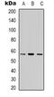 Cytochrome P450 Family 7 Subfamily B Member 1 antibody, LS-C368866, Lifespan Biosciences, Western Blot image 