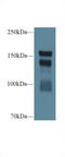 Thrombospondin 1 antibody, MBS2028337, MyBioSource, Western Blot image 