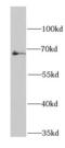 Butyrylcholinesterase antibody, FNab00833, FineTest, Western Blot image 