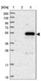 Family With Sequence Similarity 222 Member A antibody, NBP1-82225, Novus Biologicals, Western Blot image 