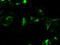 Cancer/testis antigen 1 antibody, GTX84652, GeneTex, Immunofluorescence image 