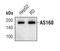TBC1 Domain Family Member 4 antibody, MA5-14840, Invitrogen Antibodies, Western Blot image 