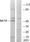 Tachykinin Receptor 1 antibody, A30846, Boster Biological Technology, Western Blot image 