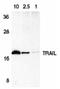 TNF Superfamily Member 10 antibody, SP1177P, Origene, Western Blot image 