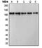 RB Transcriptional Corepressor 1 antibody, MBS821537, MyBioSource, Western Blot image 