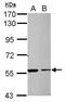 Zinc finger protein RFP antibody, PA5-28659, Invitrogen Antibodies, Western Blot image 