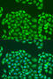 Survival Of Motor Neuron 2, Centromeric antibody, 14-479, ProSci, Immunofluorescence image 