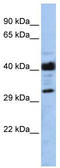 Leucine Rich Repeat Containing 57 antibody, TA330937, Origene, Western Blot image 