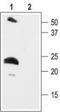 Potassium Voltage-Gated Channel Subfamily E Regulatory Subunit 2 antibody, TA328953, Origene, Western Blot image 