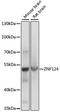 Zinc Finger Protein 124 antibody, LS-C750084, Lifespan Biosciences, Western Blot image 