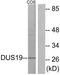 Dual Specificity Phosphatase 19 antibody, TA316136, Origene, Western Blot image 