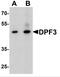 Zinc finger protein DPF3 antibody, NBP2-82087, Novus Biologicals, Western Blot image 